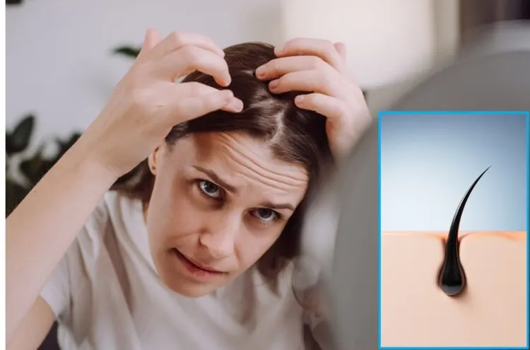 akar rambut