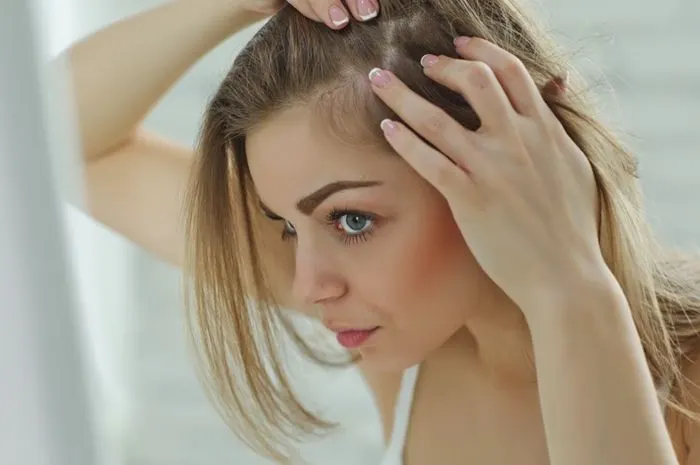 rambut menipis