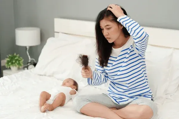 Rambut Rontok Berlebihan Pasca Melahirkan