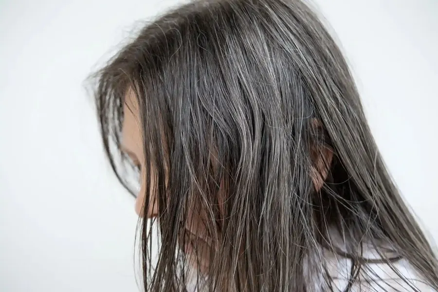 3 Makanan Pemicu Rambut Berminyak dan Tips Pencegahannya
